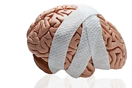 How to Claim Benefits for a Traumatic Brain Injury