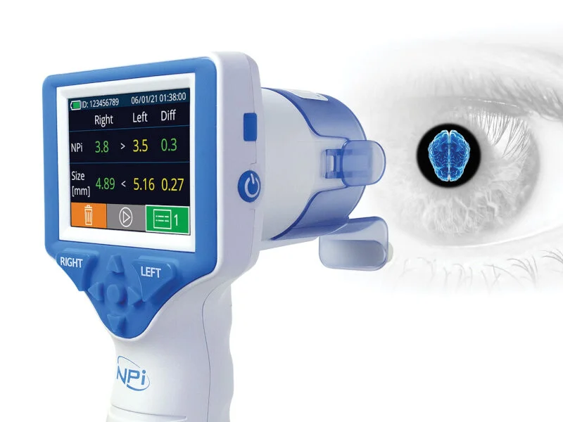 The Art and Science of Pupil Measurement in Neurological Research