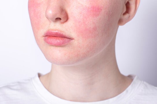 How to Deal with Skin Sensitivity: The Do’s and Don’ts