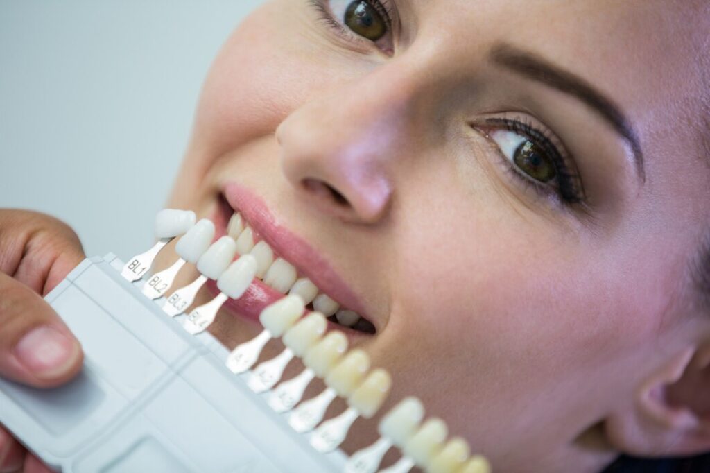 Transform Your Smile: The All on 4 Dental Implants Revolution in Australia