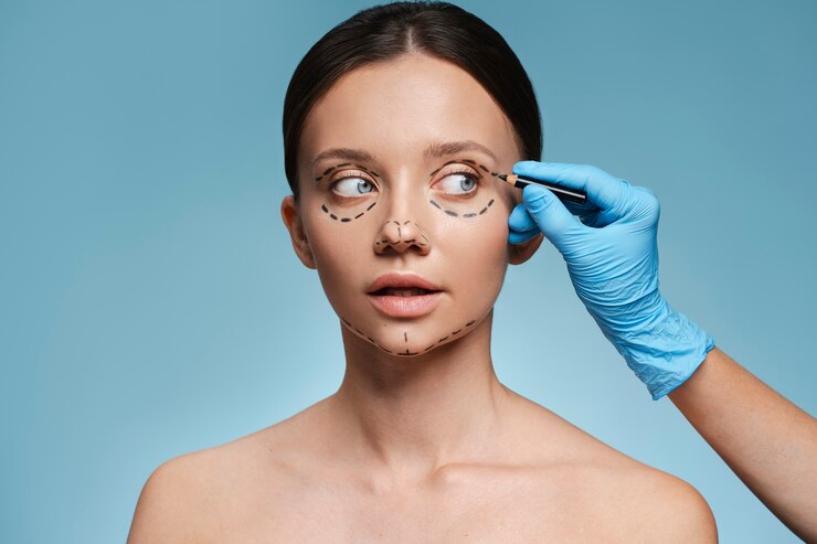 5 Things to Know Before Getting Eyelid Ptosis Surgery