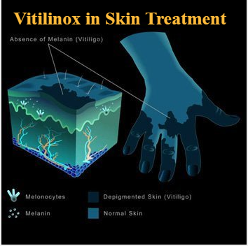 Vitilinox: A Modern Approach to Treating Skin Conditions
