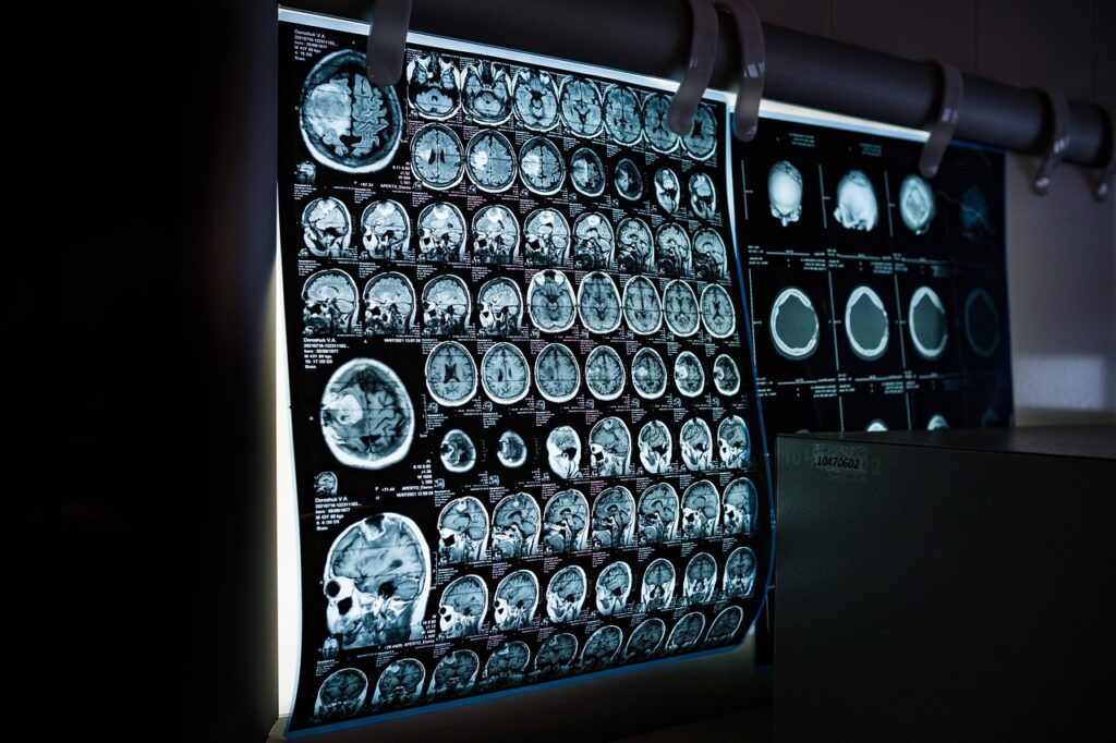 Ultrasound Tech vs Radiology Tech: A Complete Career Comparison