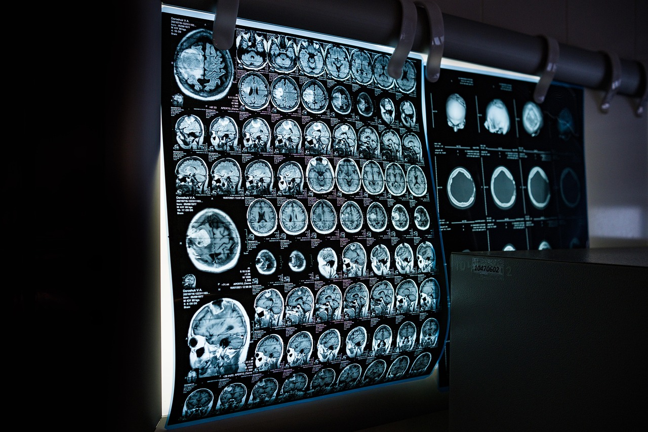 Ultrasound Tech vs Radiology Tech: A Complete Career Comparison