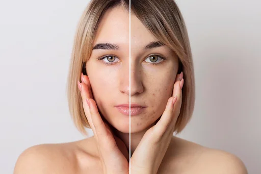 How Kojic Acid Serum Fades Dark Spots: The Science Behind Brighter Skin