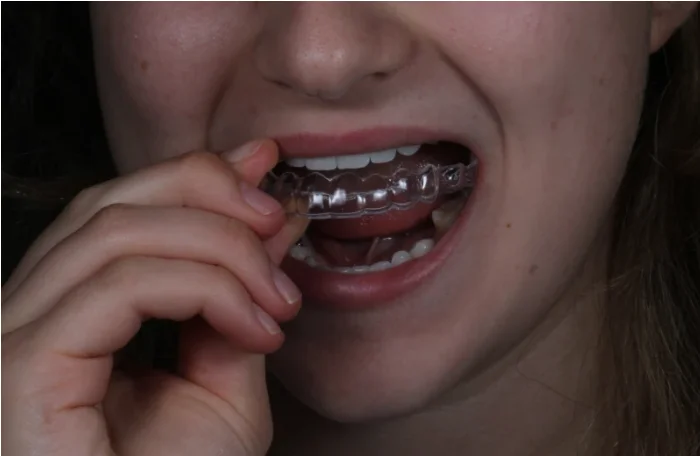 Kendall Family Dental Clinic Offering Complete Oral Care for All Ages